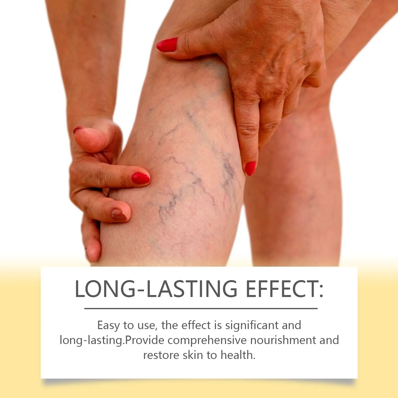 Bee Venom Extract Varicose Veins Cream, Pain & Swelling Relief Body Lotion, 100g Moisturizer