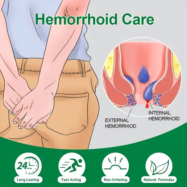 Organic Hemorrhoid Treatment Cream-Gel with Soothing Aloe Vera, Relieves Pain, Itching, and Swelling for Sensitive Skin, 1.4 oz with Finger Cots, Anti-Acne