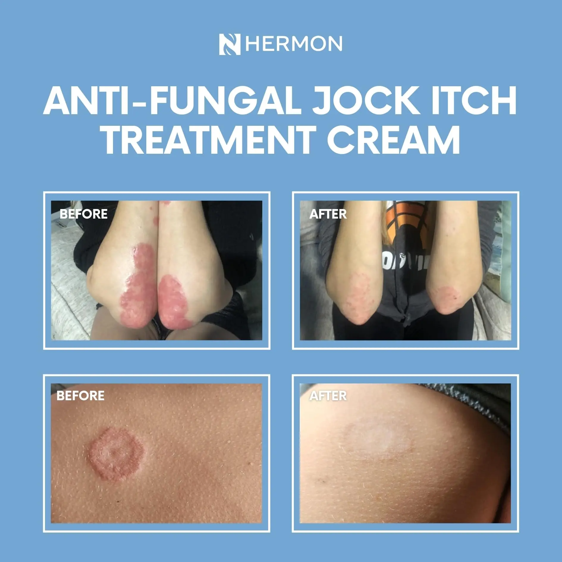 Antifungal Jock Itch Soothing Ointment (3.4 oz/100g) - Hydrating Moisturizing Body Care for Sensitive Skin