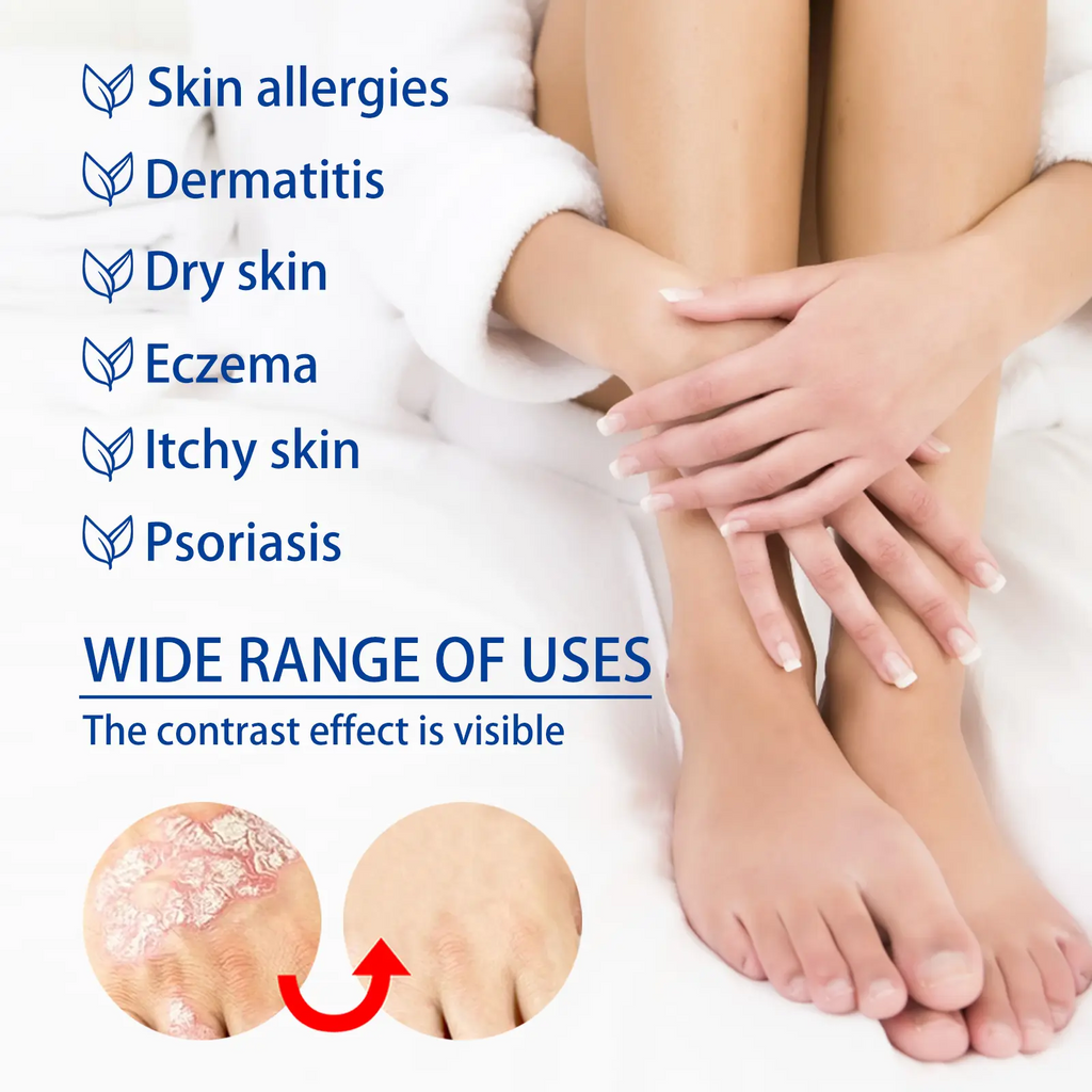 Sensitive Skin Soothing Care Cream, Natural Botanical Formula, Helps Soothe Dryness, Itching and Redness, Suitable for Daily Sensitive Skin Care, Scalp Care and Skin Moisturizing Repair, Deep Hydration